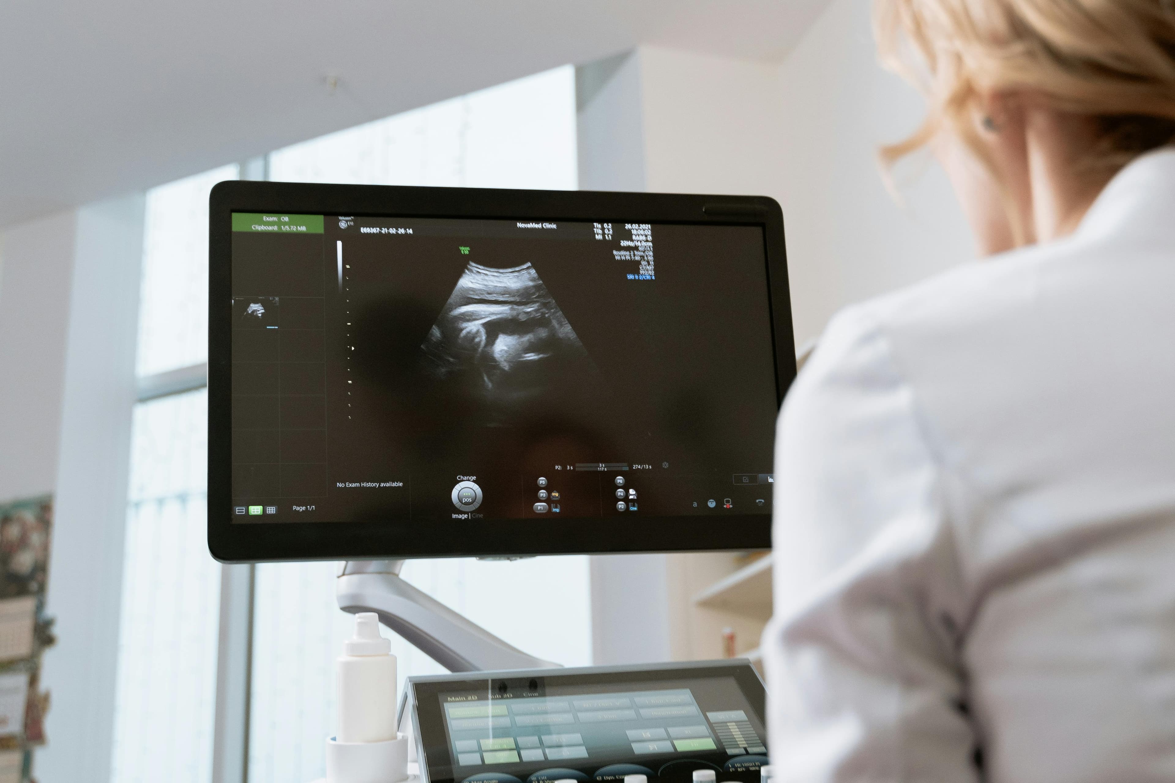 Ultrasound